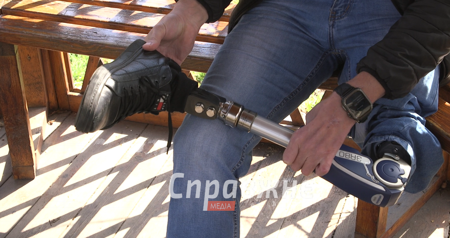 Протез Івана