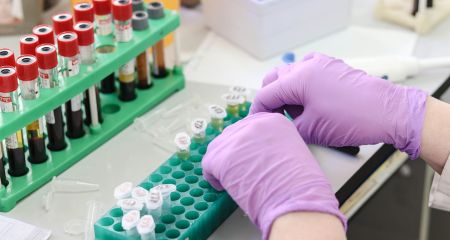 Обстежили понад 60 людей: на Запоріжжі триває моніторинг холери