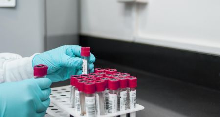 Дитина та дорослий захворіли на сальмонельоз у Запоріжжі