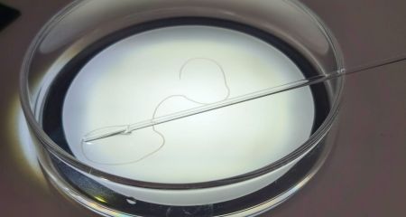 Випадок дирофіляріозу підтвердили у Запоріжжі: що це за захворювання