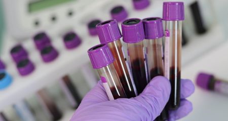 На Запоріжжі під наглядом медиків перебувають понад 2000 людей із ВІЛ