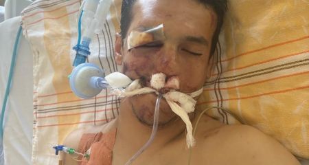 Помогите установить личность человека: пострадавший в запорожском ДТП находится без сознания