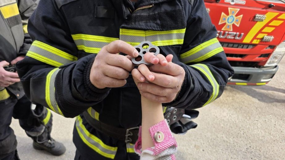 У Запоріжжі дитина встромила палець у вентиль: як рятували