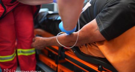В Запорожье после обстрелов лечат 82 пострадавших: среди них &ndash; дети