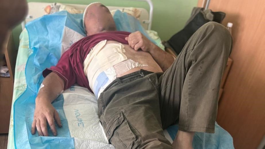 Постраждалий запорізький енергетик має осколкові поранення – подробиці